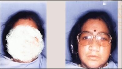 लाखों-करोड़ों नहीं, यहां सिर्फ 500 रुपये में लगता आर्टिफिशियल अंग, हर साल 50 से अधिक मरीजों की लौट रही मुस्कान