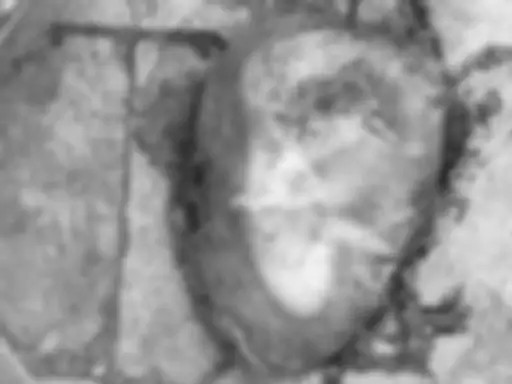 मेकाहारा में डस्टबिन के पास मिला भ्रूण:7 दिन तक CCTV खंगालने के बाद पुलिस ने अब दर्ज की FIR, आरोपियों की तलाश जारी मेकाहारा में डस्टबिन के पास मिला भ्रूण:7 दिन तक CCTV खंगालने के बाद पुलिस ने अब दर्ज की FIR, आरोपियों की तलाश जारी