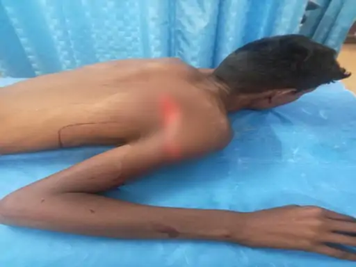 छात्र ने क्लासमेट पर कटर से किया हमला…28 टांके लगे:भिलाई में स्कूल पहुंचे परिजनों का हंगामा, शिक्षकों पर स्टूडेंट को बचाने का आरोप छात्र ने क्लासमेट पर कटर से किया हमला…28 टांके लगे:भिलाई में स्कूल पहुंचे परिजनों का हंगामा, शिक्षकों पर स्टूडेंट को बचाने का आरोप