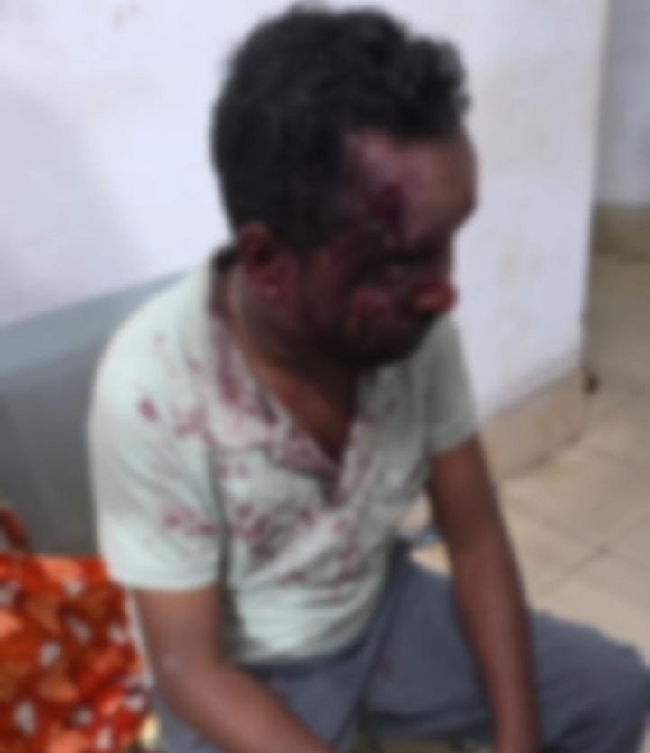 कोरबा में कानून बेबस? नशे में धुत युवकों ने घर में घुसकर मचाया आतंक कोरबा में कानून बेबस? नशे में धुत युवकों ने घर में घुसकर मचाया आतंक