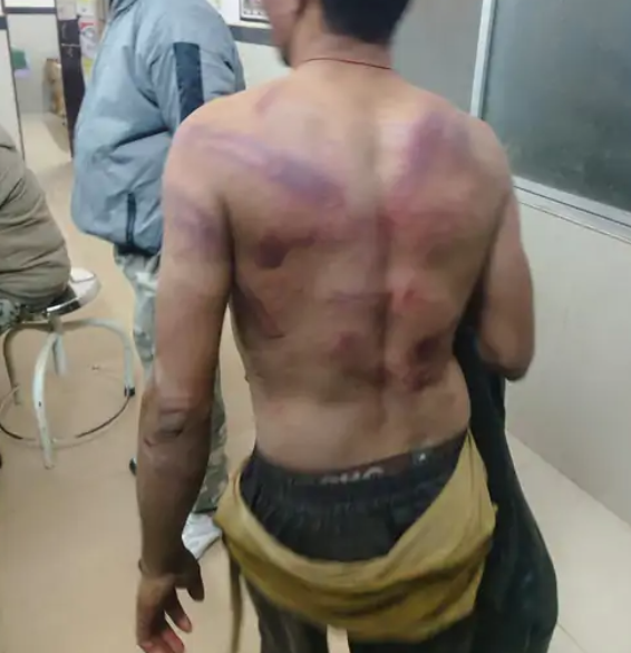 धमतरी में दरिंदगी की हद पार! तीन युवकों पर लाठी–डंडों से हमला, ‘शुद्धीकरण’ के नाम पर पेशाब तक किया