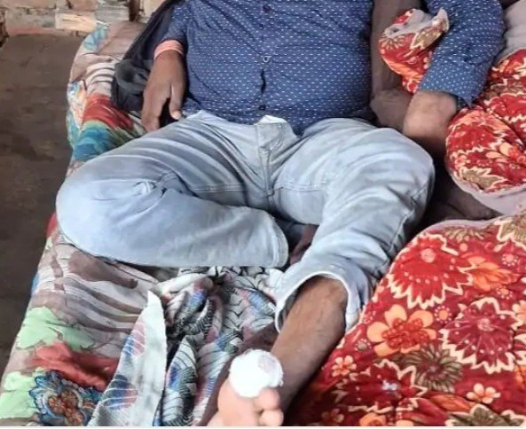 इटावा: हाईटेंशन तार की चपेट में आया युवक, गंभीर रूप से झुलसा
