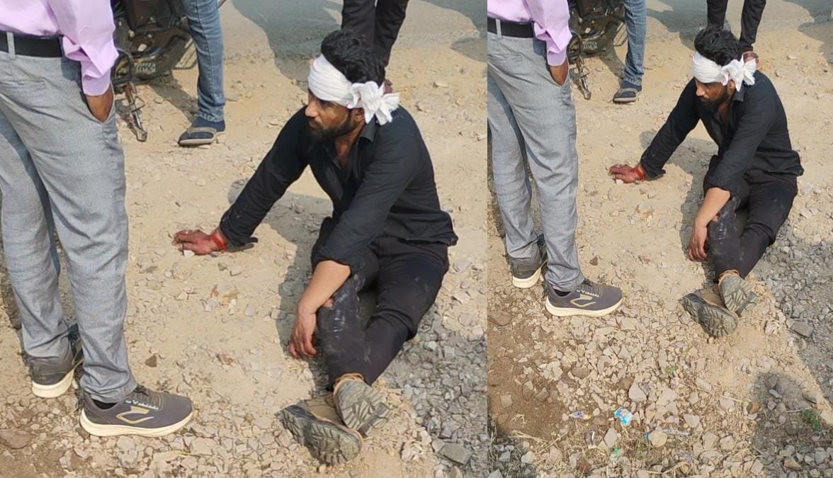 सीधी : तेज़ रफ्तार बनी जानलेवा, बोलेरो की टक्कर से युवक गंभीर घायल