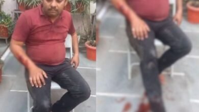 रायपुर में फिर पिटबुल डॉग का आतंक : डिलीवरी बॉय को डॉग ने बुरी तरह से नोचा