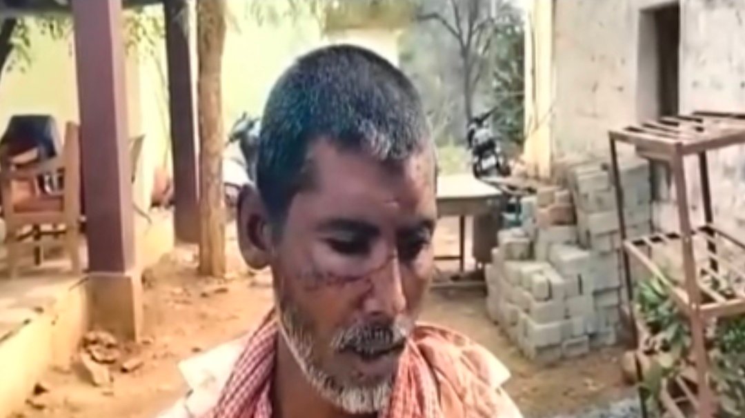 रीवा में सरेराह खूनी खेल! युवक पर गुप्ती से जानलेवा हमला, बहादुरी से बची जान