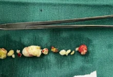 एमपी में पेंशन नियमों में बड़ा बदलाव, 2005 के बाद नियुक्त कर्मचारियों को भी मिलेगी परिवार पेंशन