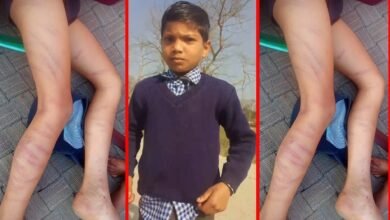 उत्तर प्रदेश: होमवर्क पूरा न करने पर कक्षा दो के छात्र पर टूटा शिक्षक का कहर, गिन कर मारे 105 डंडे…