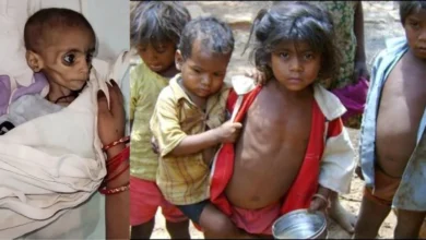 आठ रुपये में कैसे दूर होगा कुपोषण? MP में आठ साल से नहीं बढ़ी दरें; 33 फीसदी बच्चों का वजन बेहद कम आठ रुपये में कैसे दूर होगा कुपोषण? MP में आठ साल से नहीं बढ़ी दरें; 33 फीसदी बच्चों का वजन बेहद कम