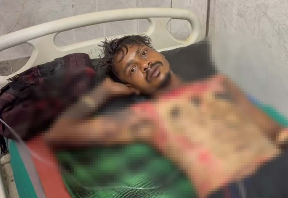 प्रेमिका से मिलने आए युवक की हत्या की कोशिश: भाई ने पेट्रोल डालकर किया आग के हवाले, गंभीर हालत में अस्पताल में कराया गया भर्ती प्रेमिका से मिलने आए युवक की हत्या की कोशिश: भाई ने पेट्रोल डालकर किया आग के हवाले, गंभीर हालत में अस्पताल में कराया गया भर्ती