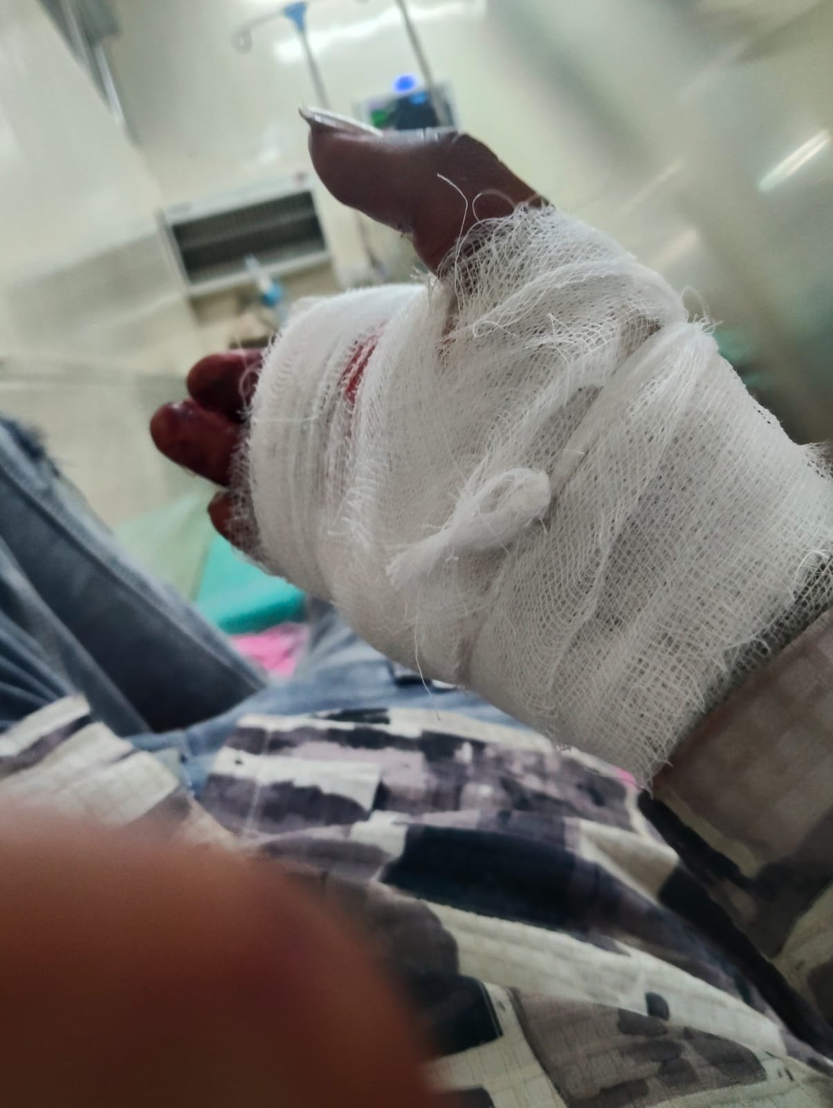 कोरबा का ये मोहल्ला बना ‘मौत का अड्डा’! गांजा-गोली के नशे में धुत लड़कों ने मासूम को सरेआम गोदा