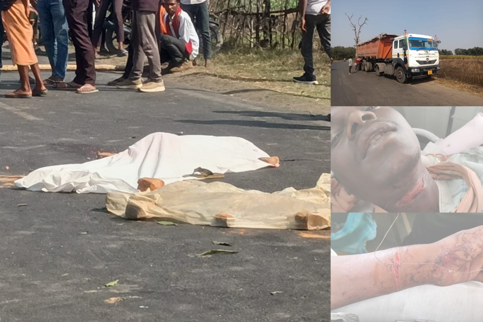 सूरजपुर: घायल युवक का इलाज कराने जा रहे 3 दोस्तों को ट्राला ने मारी टक्कर, 1 की कुचलकर मौत; 2 गंभीर