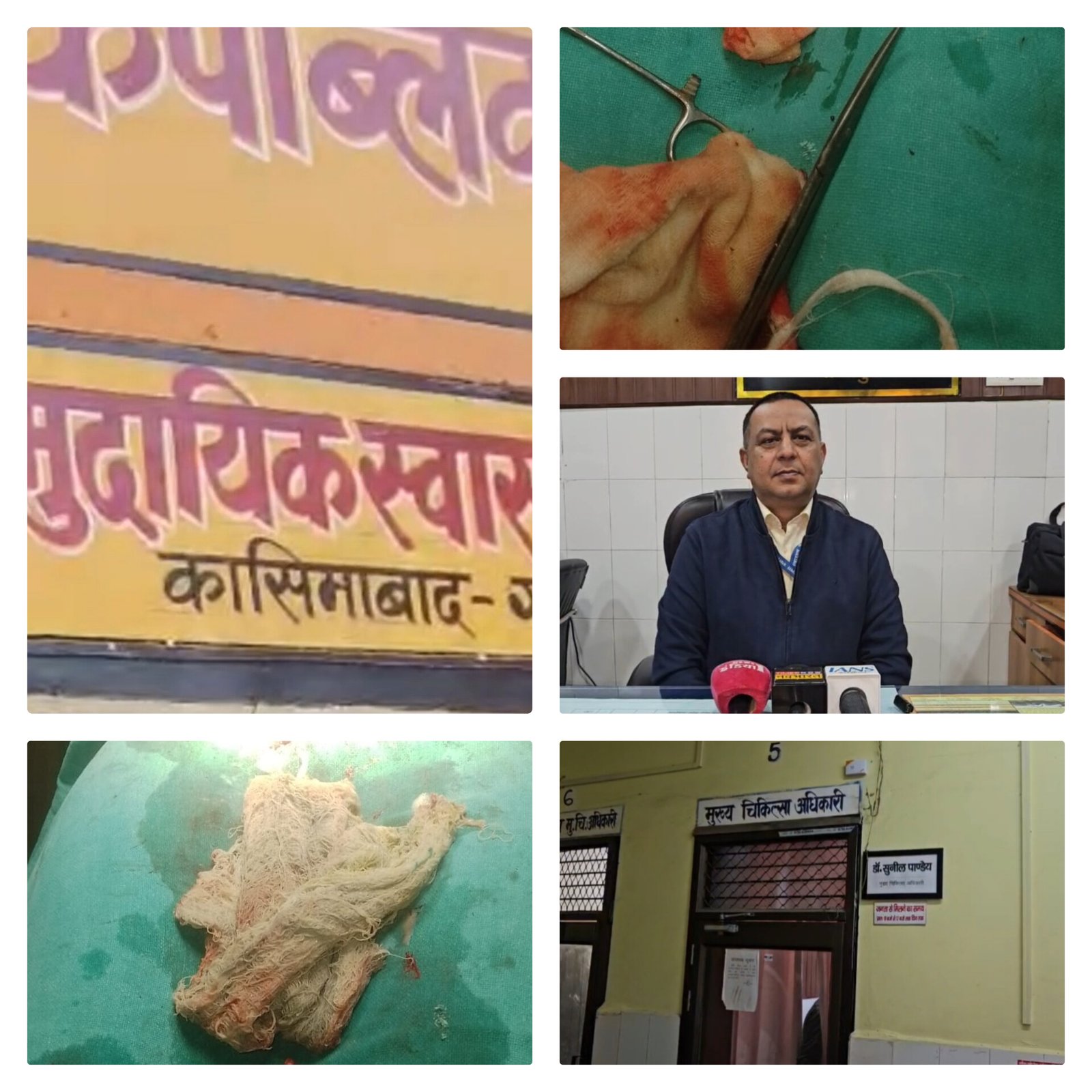 गाजीपुर में बड़ा मेडिकल लापरवाही कांड! महिला के पेट में छूटा बैंडेज, एक महीने बाद हुआ खुलासा