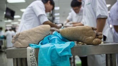 MP: भोपाल में मेडिकल छात्रा की दर्दनाक मौत, बाथरूम में शव मिलने से कॉलेज परिसर में सनसनी