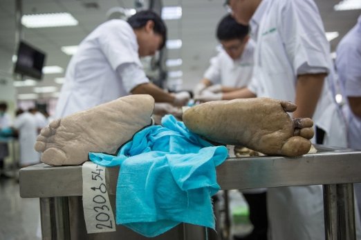 MP: भोपाल में मेडिकल छात्रा की दर्दनाक मौत, बाथरूम में शव मिलने से कॉलेज परिसर में सनसनी