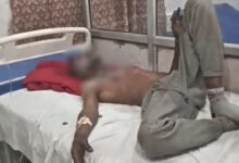 बरेली में थाने के सामने डिलीवरी बॉय ने खुद को लगाई आग, पुलिस के किस रवैये से था परेशान?