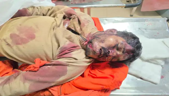 छत्तीसगढ़ में तीन अलग-अलग हादसों में पांच लोगों की मौत, कई गंभीर घायल