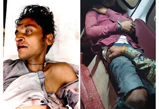 धमतरी में दर्दनाक हादसा: टहलने निकले दो दोस्त, एक की मौत, दूसरा जिंदगी की जंग में