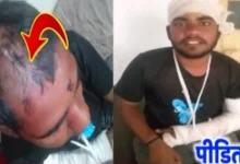 रीवा में दबंगई: होली के दिन युवक की बेरहमी से पिटाई, हफ्ते भर बाद भी पुलिस के हाथ खाली