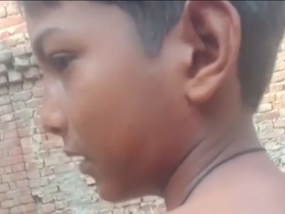 उत्तर प्रदेश: बहराइच के स्कूल में शिक्षिका ने की मासूम बच्चे की पिटाई, बच्चे के पिता ने लगाए कई आरोप उत्तर प्रदेश: बहराइच के स्कूल में शिक्षिका ने की मासूम बच्चे की पिटाई, बच्चे के पिता ने लगाए कई आरोप