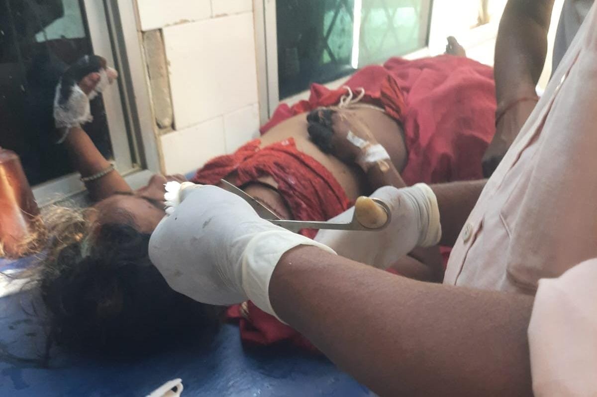 सूरजपुर: झाड़ियों में छिपा था मौत का साया… महुआ बिन रही महिला पर अचानक टूट पड़ा जंगली सूअर सूरजपुर: झाड़ियों में छिपा था मौत का साया… महुआ बिन रही महिला पर अचानक टूट पड़ा जंगली सूअर