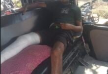 मैहर पुलिस पर युवक की बेरहमी से पिटाई का आरोप: पैर फ्रैक्चर, पत्नी ने CM हेल्पलाइन में की शिकायत