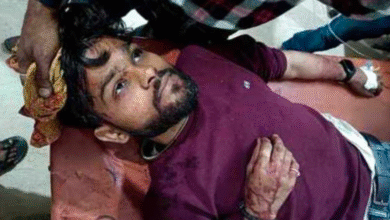 उत्तर प्रदेश: श्रावस्ती में सर्राफा व्यवसायी के सिर पर रॉड से वार कर फरार हुए बदमाश, मचा हड़कंप