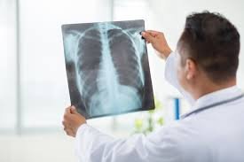 AI से बने नकली X-ray ने बढ़ाई चिंता, डॉक्टर भी हुए कन्फ्यूज