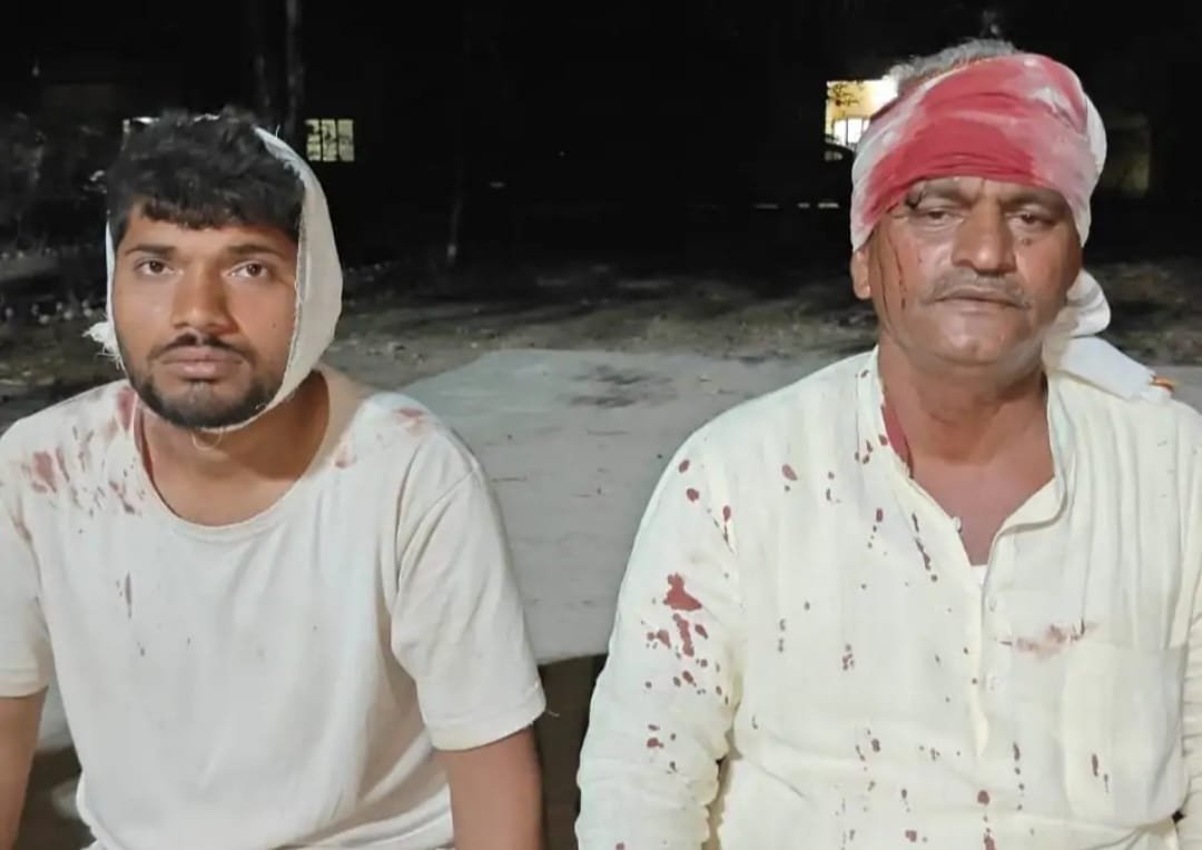 सुल्तानपुर में दो समुदायों में खूनी भिड़ंत! लाठी-डंडों से जंग, दर्जनभर घायल