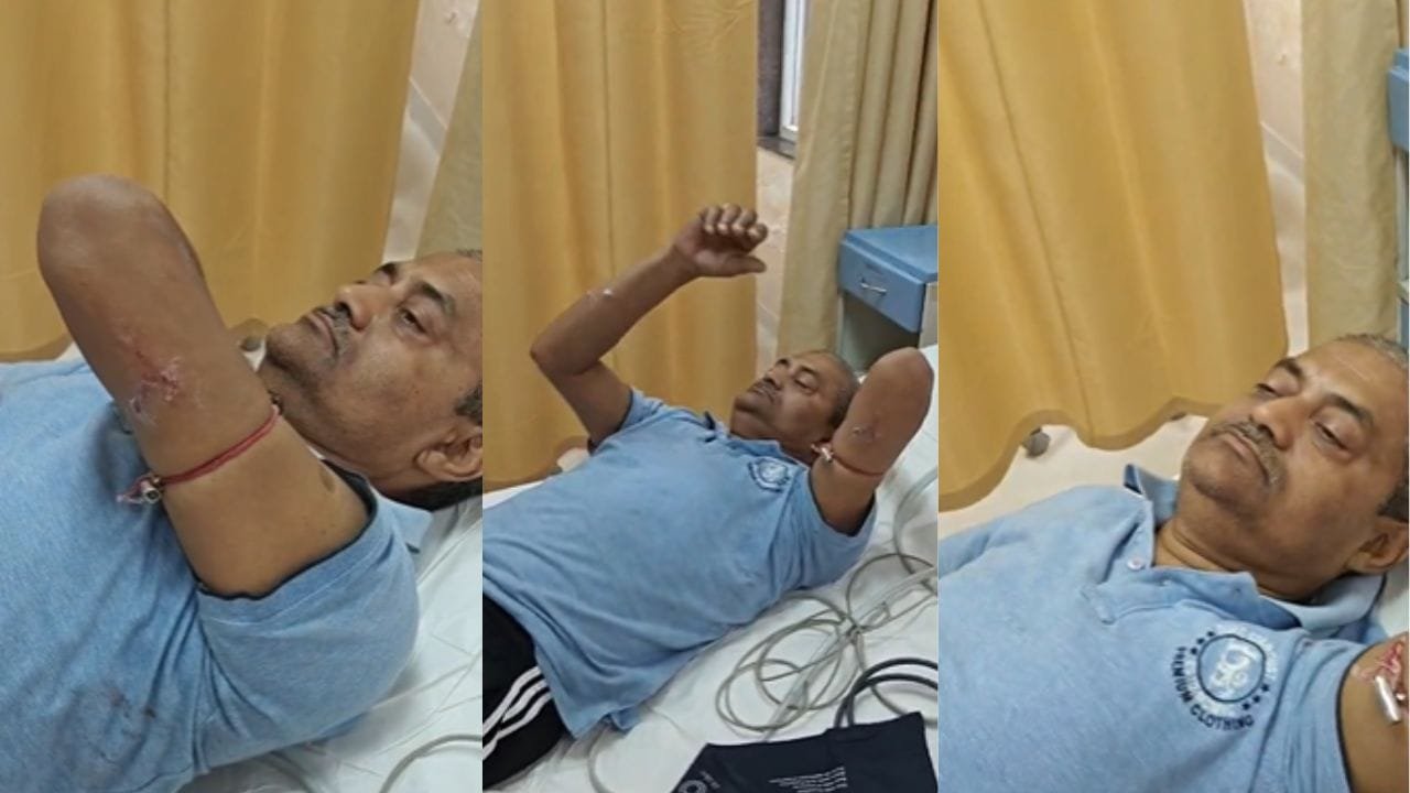 ग्रेटर नोएडा में आवारा कुत्तों का आतंक, रक्षा मंत्रालय के पूर्व अधिकारी पर किया हमला