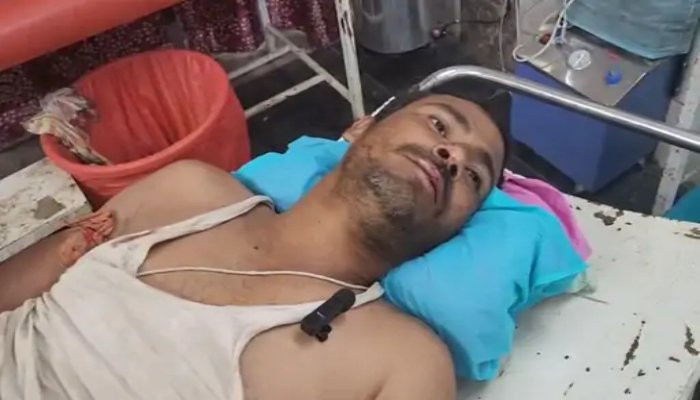 बिजली सुधार कार्य के दौरान मजदूर झुलसा: करंट लगने से खंभे से गिरा, सुरक्षा इंतजामों पर उठे सवाल बिजली सुधार कार्य के दौरान मजदूर झुलसा: करंट लगने से खंभे से गिरा, सुरक्षा इंतजामों पर उठे सवाल