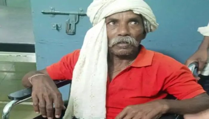 कोरबा के जंगल में भालू का हमला: तेंदूपत्ता तोड़ने गए दो ग्रामीण घायल, चेहरे और हाथों पर गंभीर चोटें