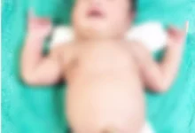 जगदलपुर मेकाज में चमत्कार जैसा मामला: ओडिशा की महिला ने 5.09 किलो के स्वस्थ बच्चे को दिया जन्म, डॉक्टर भी हैरान