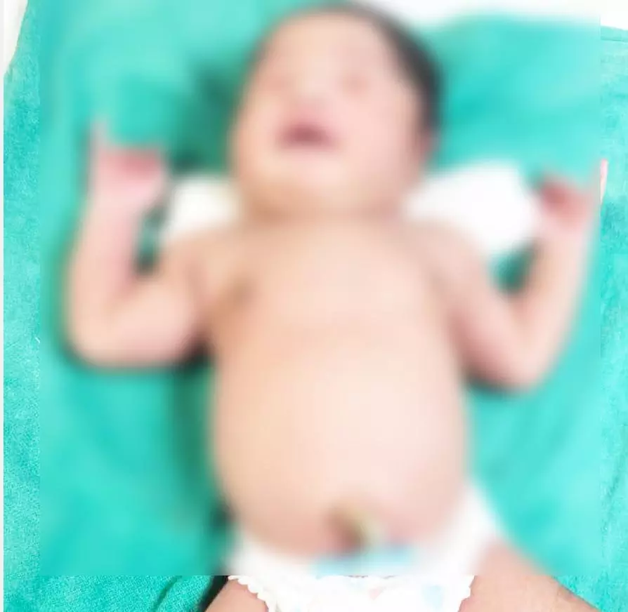 जगदलपुर मेकाज में चमत्कार जैसा मामला: ओडिशा की महिला ने 5.09 किलो के स्वस्थ बच्चे को दिया जन्म, डॉक्टर भी हैरान जगदलपुर मेकाज में चमत्कार जैसा मामला: ओडिशा की महिला ने 5.09 किलो के स्वस्थ बच्चे को दिया जन्म, डॉक्टर भी हैरान