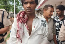 रायपुर में दिनदहाड़े हमला: युवक पर चाकू से ताबड़तोड़ वार, गंभीर हालत में अस्पताल में भर्ती