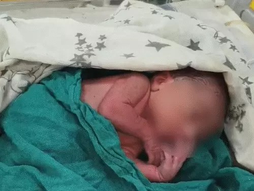 नवजात को प्लास्टिक में लपेटकर सड़क किनारे फेंका:रोने की आवाज सुनकर पहुंचे ग्रामीणों ने उठाया, एक घंटे पहले हुआ जन्म