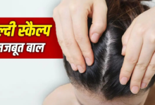 बाल तभी होंगे हेल्दी जब स्कैल्प रहेगी हेल्दी, सिर की त्वचा की ऐसे करें केयर