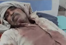 जमीन की पैमाइश करने गए, पिता-पुत्र पर कुल्हाड़ी-सरिए चलाए:दोनों को लहूलुहान हालत में पहुंचाया हॉस्पिटल, चाचा-ताऊ के परिवार में झगड़ा