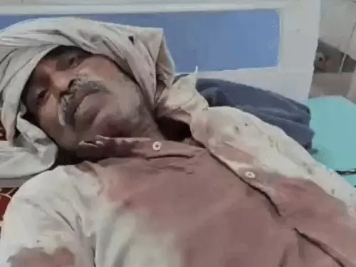 जमीन की पैमाइश करने गए, पिता-पुत्र पर कुल्हाड़ी-सरिए चलाए:दोनों को लहूलुहान हालत में पहुंचाया हॉस्पिटल, चाचा-ताऊ के परिवार में झगड़ा