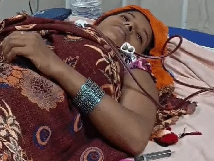 डिलीवरी के बाद प्रसूता की तबीयत बिगड़ी, डायलिसिस शुरू:गर्भ में ही हो गई थी बच्चे की मौत, ज्यादा ब्लीडिंग की वजह से हालत गंभीर