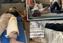 बिहार के अस्पताल में ‘जुगाड़’ से इलाज! प्लास्टर नहीं… गत्ते के सहारे बांधा टूटा पैर