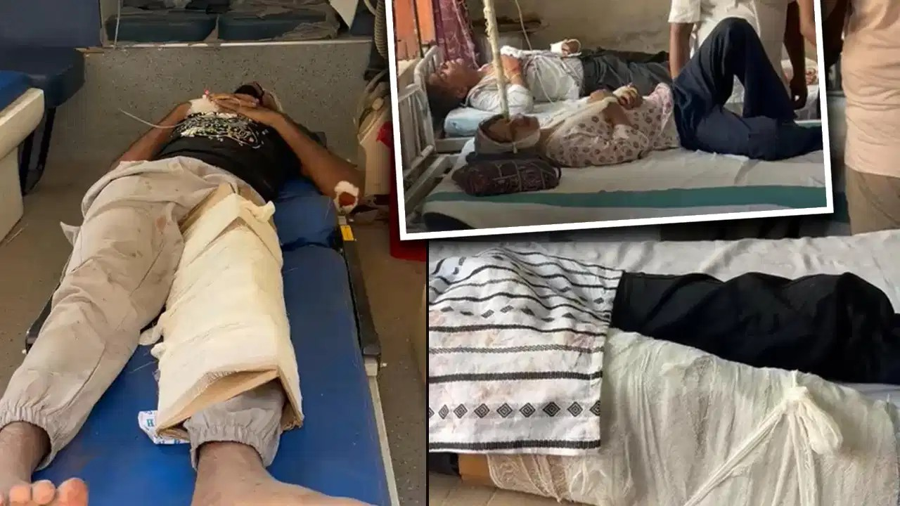 बिहार के अस्पताल में ‘जुगाड़’ से इलाज! प्लास्टर नहीं… गत्ते के सहारे बांधा टूटा पैर