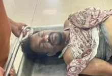 जन्मदिन की खुशियां मातम में बदलीं: AC कंप्रेसर ब्लास्ट से पिता की मौत, बेटा गंभीर