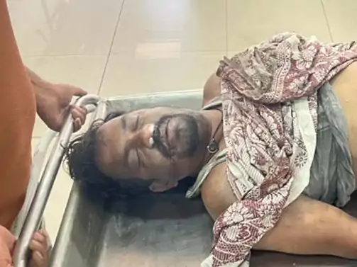 जन्मदिन की खुशियां मातम में बदलीं: AC कंप्रेसर ब्लास्ट से पिता की मौत, बेटा गंभीर