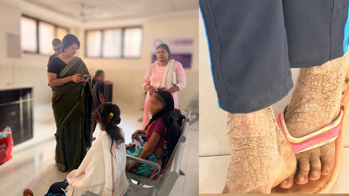 बीमार बच्ची के लिए मदद बनी संजीवनी, AIIMS में इलाज शुरू होने से परिवार को राहत