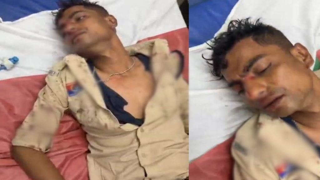 बिलासपुर में पुलिसकर्मी पर जानलेवा हमला, डायल-112 जवान सिम्स में भर्ती, आरोपी गिरफ्तार