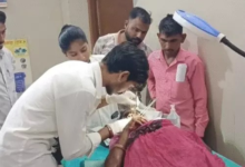 बांसवाड़ा में महिला का मुंह खा गया कुत्ता:खाना खाकर घर के बाहर बैठीं थी, अचानक किया अटैक