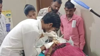 बांसवाड़ा में महिला का मुंह खा गया कुत्ता:खाना खाकर घर के बाहर बैठीं थी, अचानक किया अटैक