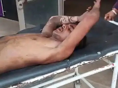 ट्रेन के इंजन पर चढ़ने वाले स्टूडेंट्स की मौत:7 दिन में 3 अस्पताल बदले, हाईटेंशन लाइन की चपेट में आया था ट्रेन के इंजन पर चढ़ने वाले स्टूडेंट्स की मौत:7 दिन में 3 अस्पताल बदले, हाईटेंशन लाइन की चपेट में आया था
