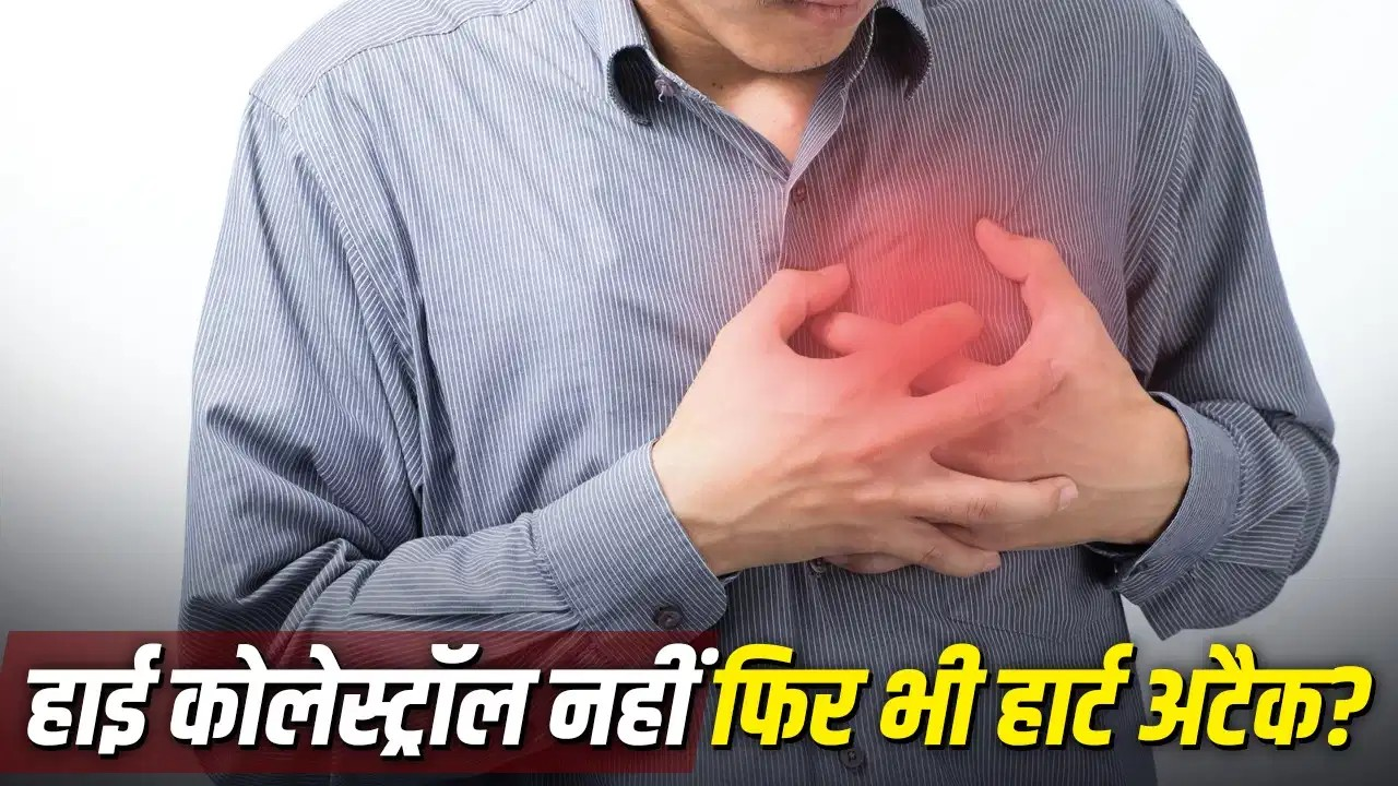 क्या बिना हाई कोलेस्ट्रॉल के भी आ सकता है हार्ट अटैक?