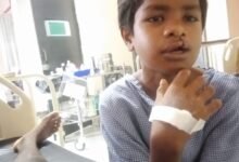 15 साल तक कटे होंठ-तालु से जूझता रहा बच्चा: ‘चिरायु’ दल ने कराया मुफ्त ऑपरेशन, चेहरे पर लौटी मुस्कान